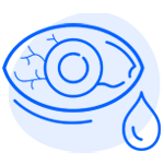 Pink eye